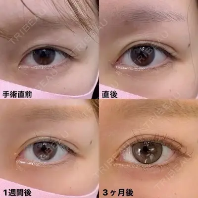 湘南美容クリニック 銀座院の症例