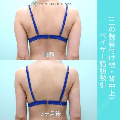 WOM CLINIC GINZA （ワム クリニック ギンザ） 佐々木 和司医師の症例
