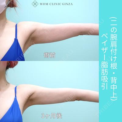 WOM CLINIC GINZA （ワム クリニック ギンザ） 佐々木 和司医師の症例