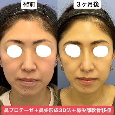 湘南美容クリニック 銀座院 葛島 魁人医師の症例