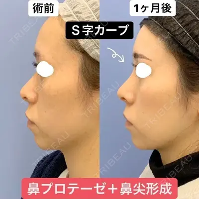 湘南美容クリニック 銀座院 葛島 魁人医師の症例