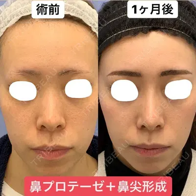 湘南美容クリニック 銀座院 葛島 魁人医師の症例
