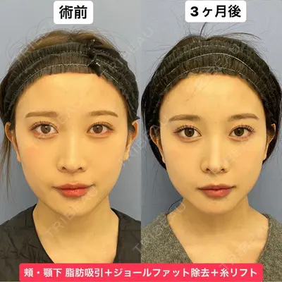 湘南美容クリニック 銀座院 葛島 魁人医師の症例