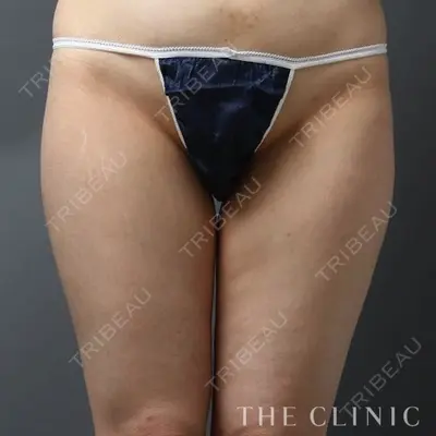THE CLINIC（ザ・クリニック） 東京院 大橋 昌敬医師の症例