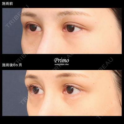 プリモ麻布十番クリニック 大場教弘医師の症例