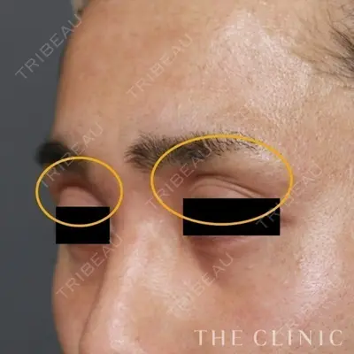 THE CLINIC（ザ・クリニック） 東京院の症例