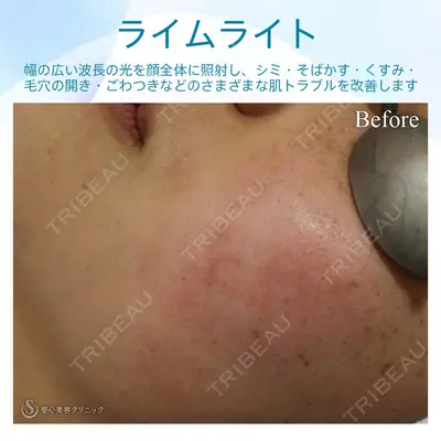 聖心美容クリニック 熱海院 小林 美幸（皮膚科）医師の症例