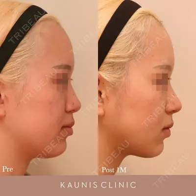 KAUNIS CLINIC（カウニスクリニック） 高野 敏郎医師の症例