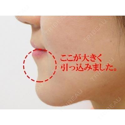 カトレア歯科・美容クリニック 辻 和志医師の症例
