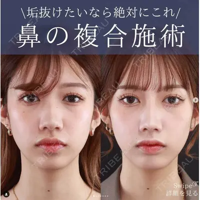 札幌TAクリニックの症例
