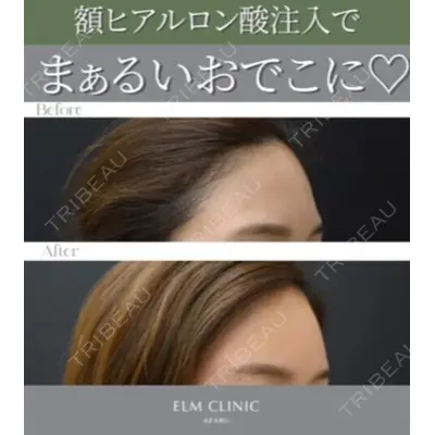 美容皮膚科エルムクリニック 京都院の症例
