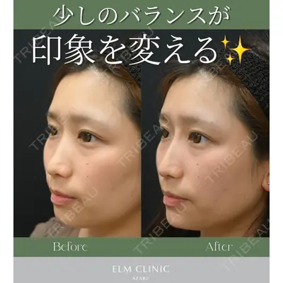 美容皮膚科エルムクリニック 京都院の症例