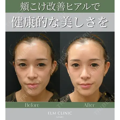 美容皮膚科エルムクリニック 京都院の症例