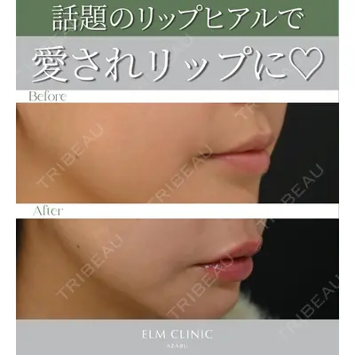 美容皮膚科エルムクリニック 京都院の症例