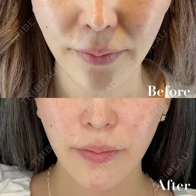 HAAB×DREAM BEAUTY CLINIC 東京本院の症例