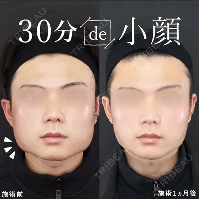 新宿TAクリニック 高田 泰宜医師の症例