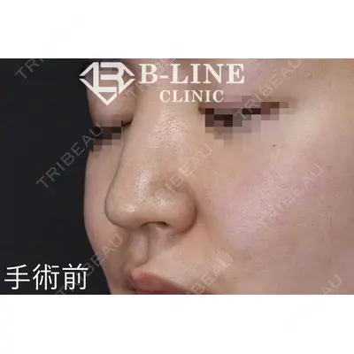 B-LINE CLINIC 池袋院 小池 康弘医師の症例