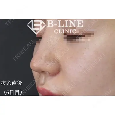 B-LINE CLINIC 池袋院 小池 康弘医師の症例