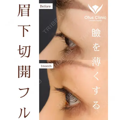 Otus Clinic 【オータスクリニック】 中 徳太郎医師の症例