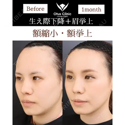 Otus Clinic 【オータスクリニック】 中 徳太郎医師の症例