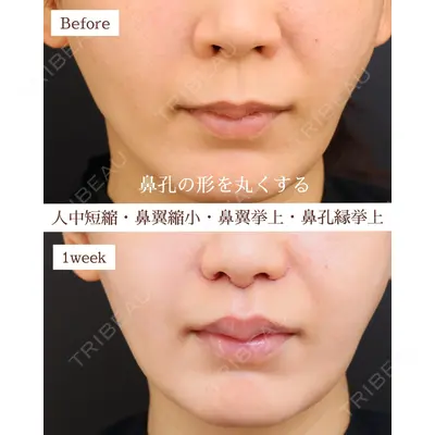Otus Clinic 【オータスクリニック】 中 徳太郎医師の症例