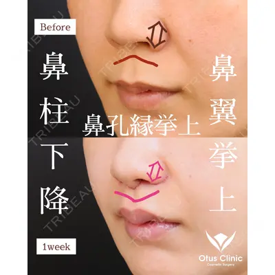 Otus Clinic 【オータスクリニック】 中 徳太郎医師の症例