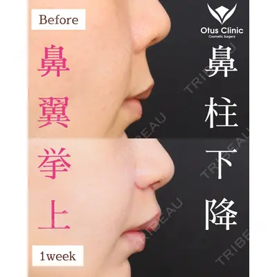 Otus Clinic 【オータスクリニック】 中 徳太郎医師の症例
