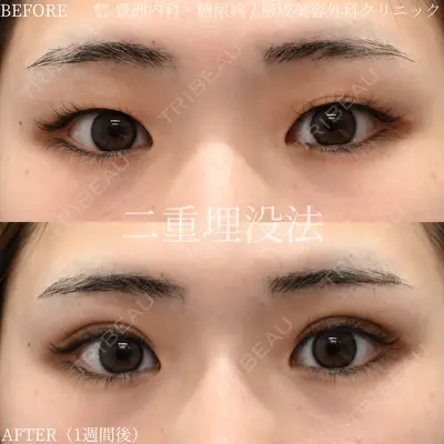 豊洲内科・糖尿病 / 形成・美容外科クリニック 澤口 悠医師の症例