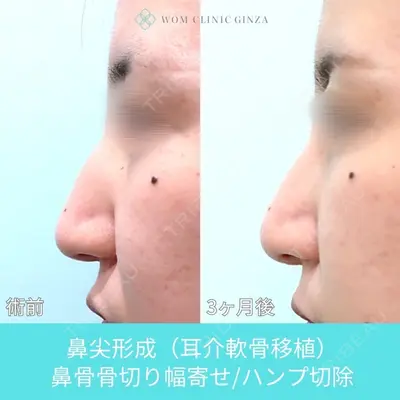 WOM CLINIC GINZA （ワム クリニック ギンザ） 佐々木 和司医師の症例