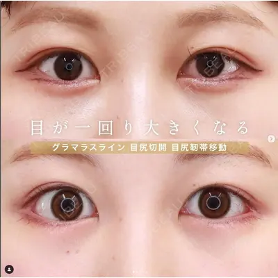 大阪TAクリニック 平松 敦医師の症例