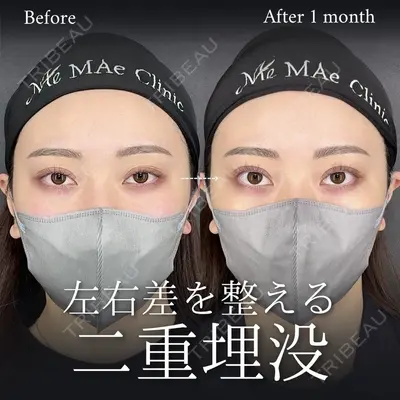 《前之園 健太》（MAe Clinic 大阪院）の症例一覧 | トリビュー
