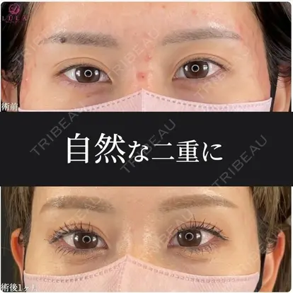 藤川 一朗先生の症例
