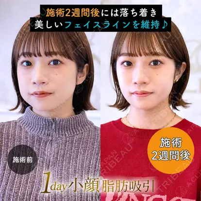 柴田 貴志先生の症例