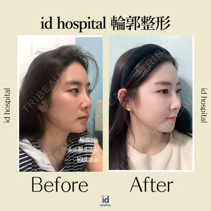 id（アイディ）美容外科の症例