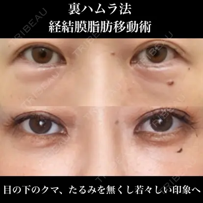 冨田 祥一先生の症例