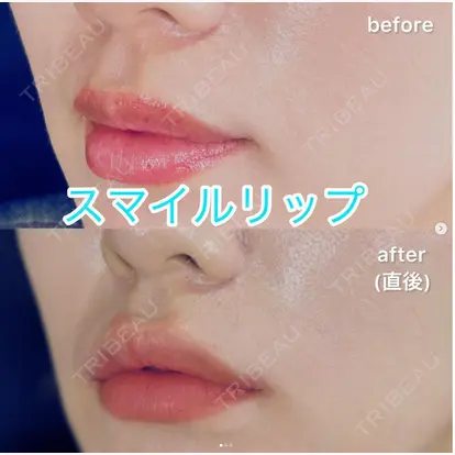 桂巻 綾乃先生の症例