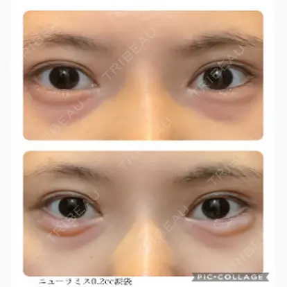 山中大介先生の症例