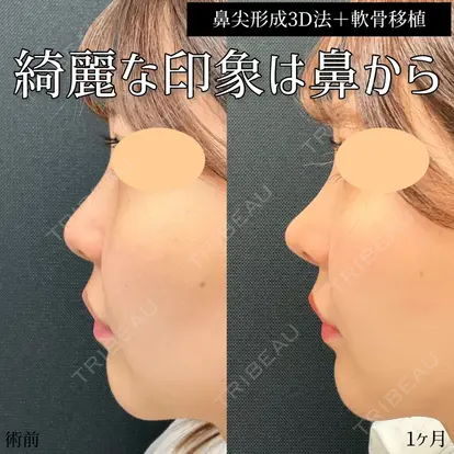東京シンデレラ美容外科 大宮院の症例