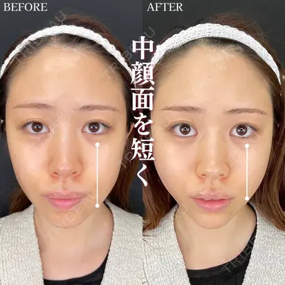 山本 泰輔先生の症例