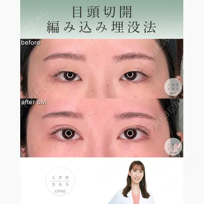 立雅恵先生の症例