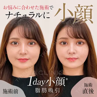 住田 篤紀先生の症例