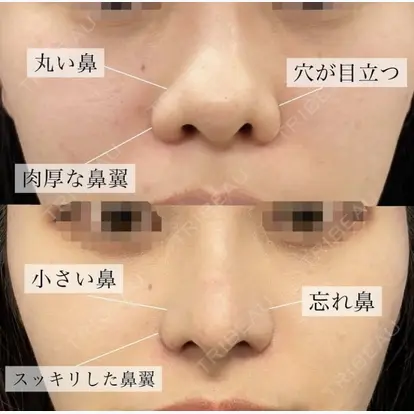 理事長　杉崎　裕斗先生の症例