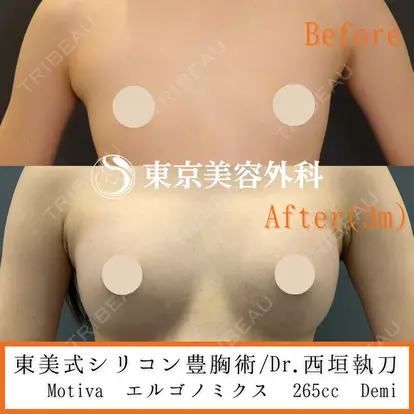 西垣 宏美先生の症例