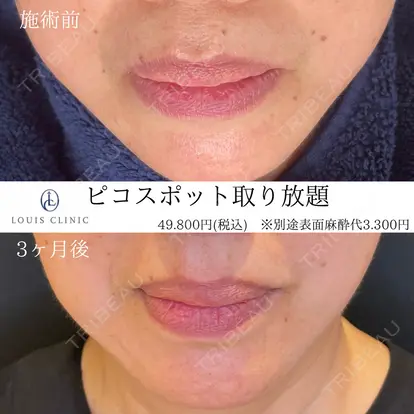 小松 塁先生の症例