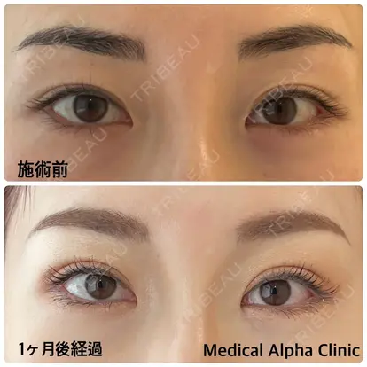 小西 恒先生の症例
