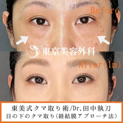 田中 宏明先生の症例