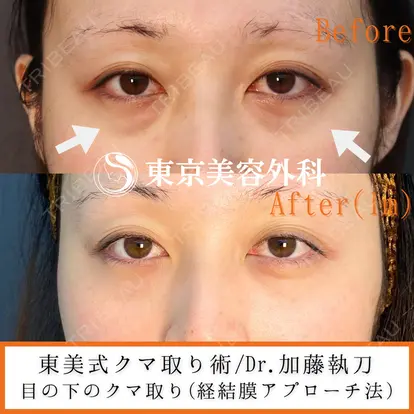 加藤 秀輝先生の症例