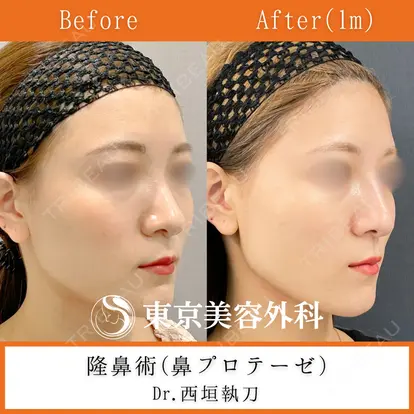 西垣 宏美先生の症例