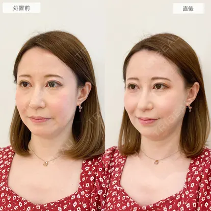 三橋 克之先生の症例