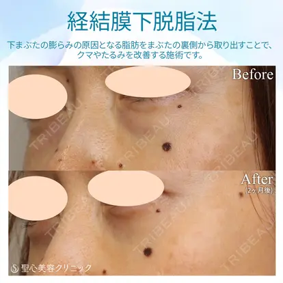 伊藤 哲郎先生の症例